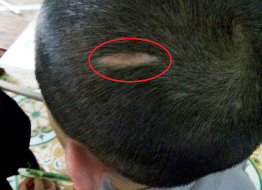 Trần tình của sư thầy bạo hành bé trai 10 tuổi thâm tím khắp người-4