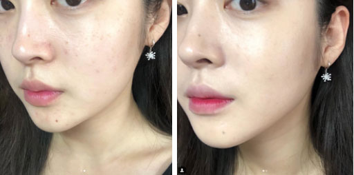 Da sạm, mắt mệt mỏi sau 1 đêm không ngon giấc sẽ không còn là vấn đề nếu bạn biết 5 tuyệt kỹ này-3