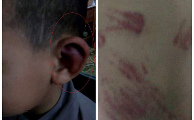 TT Thích Đức Thiện: Không thể chấp nhận việc nhà sư dùng đòn roi bạo hành trẻ mồ côi-1