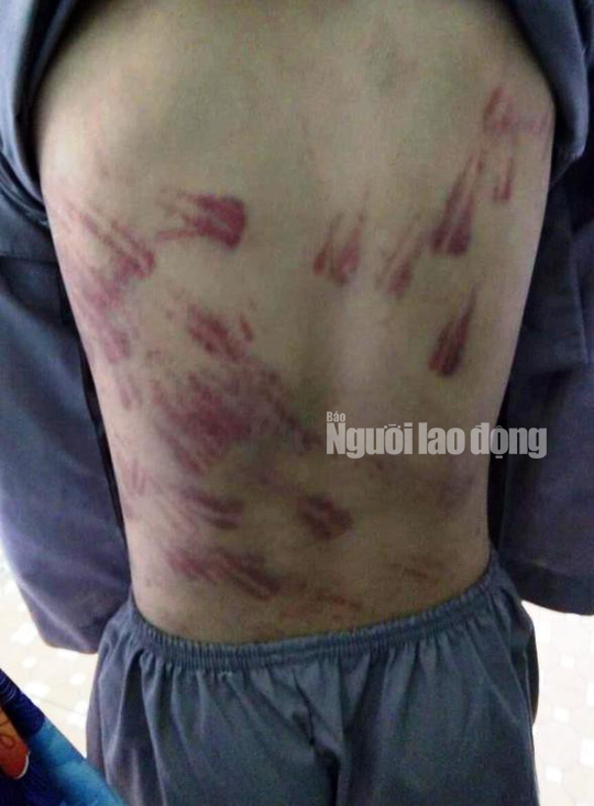 TT Thích Đức Thiện: Không thể chấp nhận việc nhà sư dùng đòn roi bạo hành trẻ mồ côi-2