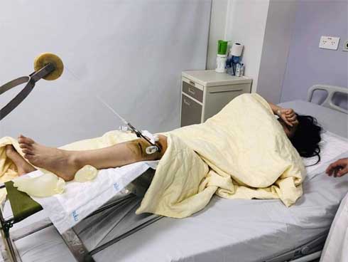 Đã có manh mối chiếc xe Range Rover đâm nữ sinh rồi bỏ chạy-3