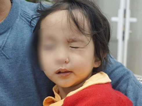 Nắng nóng nhiều trẻ nhỏ, người lớn méo miệng khi đang ngủ: BS cảnh báo thói quen xấu-3