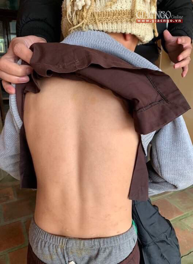 Thông tin bất ngờ vụ việc bé trai bị sư thầy đánh tím bầm cơ thể-7