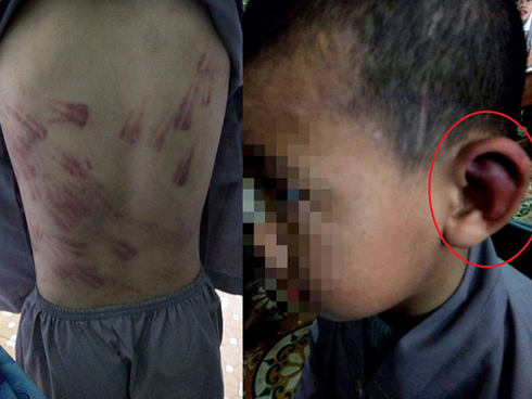 Gia cảnh khốn khó của bé trai 10 tuổi bị sư trụ trì đánh bầm tím khắp cơ thể-4