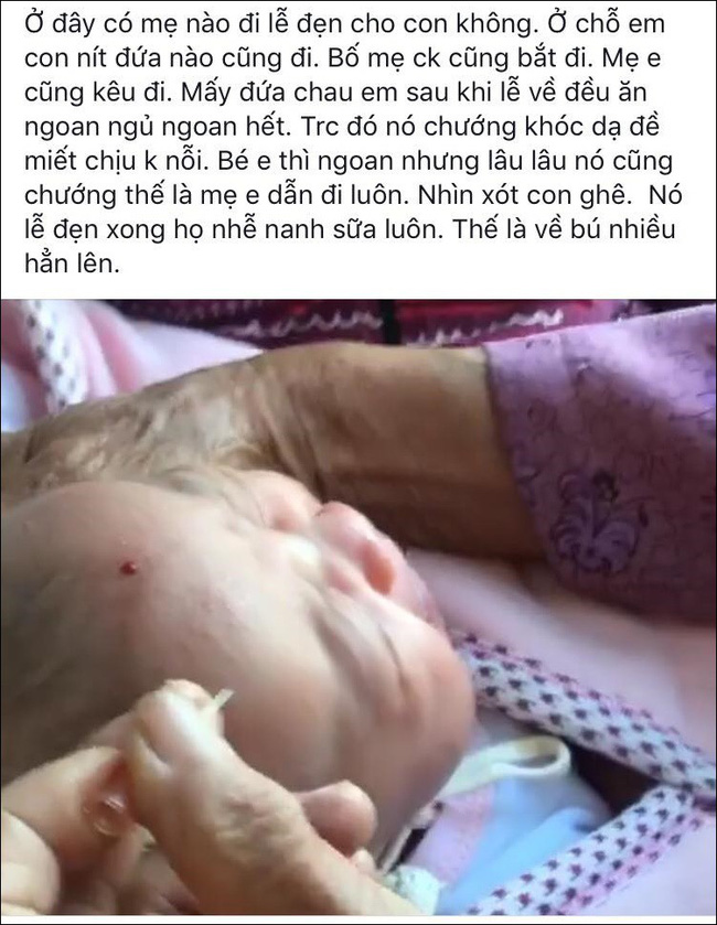 Bác sĩ nói gì về việc dùng kim châm vào đầu trẻ sơ sinh cho chảy máu để con ăn khỏe, nhanh lớn-1