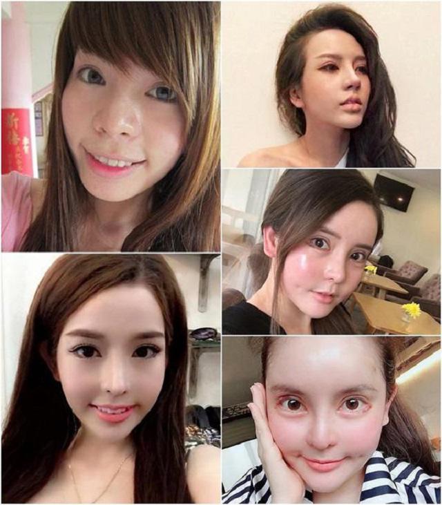 Rùng mình trước chuyện phẫu thuật thẩm mỹ của 3 búp bê di động nghiện dao kéo-1