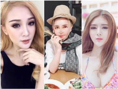 Hình ảnh gây sốc hội chị em: Cô gái định làm môi trái tim căng mọng, ai ngờ cắt lỗi môi hở răng lạnh-2
