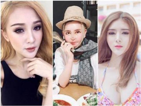 Rùng mình trước chuyện phẫu thuật thẩm mỹ của 3