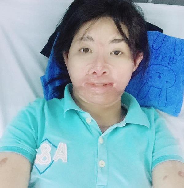 Sau 700 ngày bị chồng tẩm xăng đốt, người mẹ từng rất xinh đẹp đếm ngược để được gặp con-2