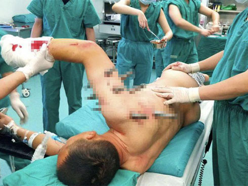 Em bé sống sót sau 35 giờ bị chôn vùi dưới cái lạnh -26 độ tại Nga-3