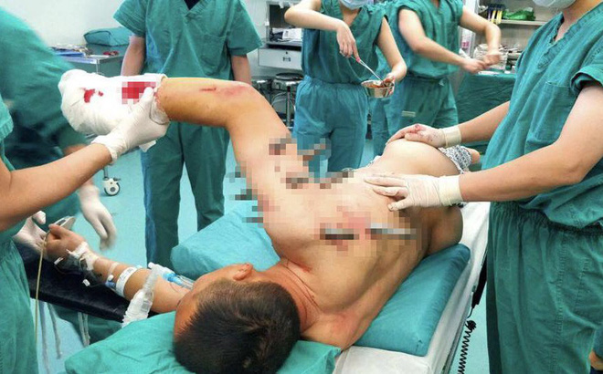 Sống sót thần kỳ sau khi bị 10 chiếc đinh dài 30 cm xuyên thủng người-1