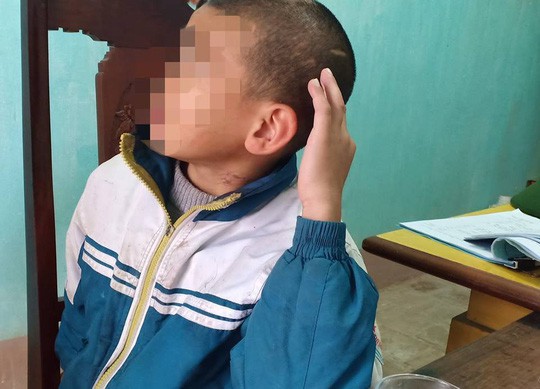 Gia cảnh khốn khó của bé trai 10 tuổi bị sư trụ trì đánh bầm tím khắp cơ thể-2