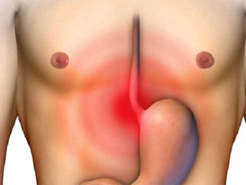 Ung thư dạ dày có tỷ lệ tử vong cao: Làm đủ 4 việc để sớm ngăn chặn mầm bệnh sinh sôi-5