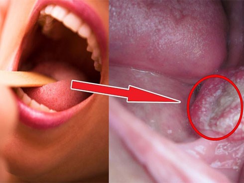 BS cảnh báo 5 thói quen bạn nên thay đổi ngay vì có thể 