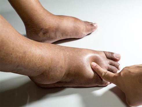 5 hiểu nhầm về công dụng của bồn ngâm chân hồng ngoại