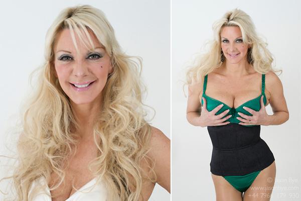 Những con thiêu thân nghiện dao kéo đến tàn tạ nhan sắc: Đừng mù quáng như họ!-11