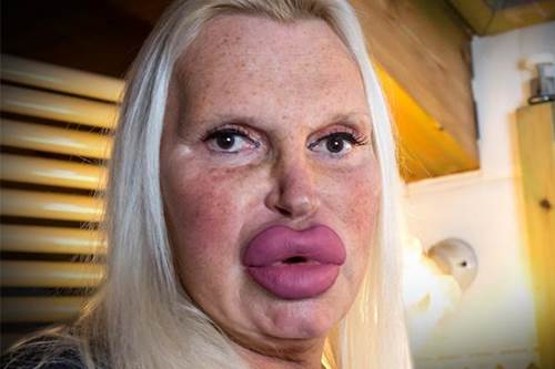 Những con thiêu thân nghiện dao kéo đến tàn tạ nhan sắc: Đừng mù quáng như họ!-2