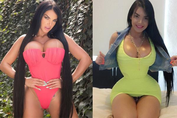 Những con thiêu thân nghiện dao kéo đến tàn tạ nhan sắc: Đừng mù quáng như họ!-7