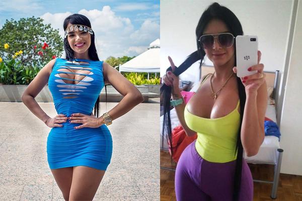 Những con thiêu thân nghiện dao kéo đến tàn tạ nhan sắc: Đừng mù quáng như họ!-9