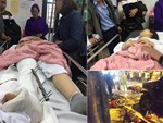 Ô tô Lexus tông gần chục xe trên phố Hà Nội: Sức khỏe các nạn nhân giờ ra sao?-2