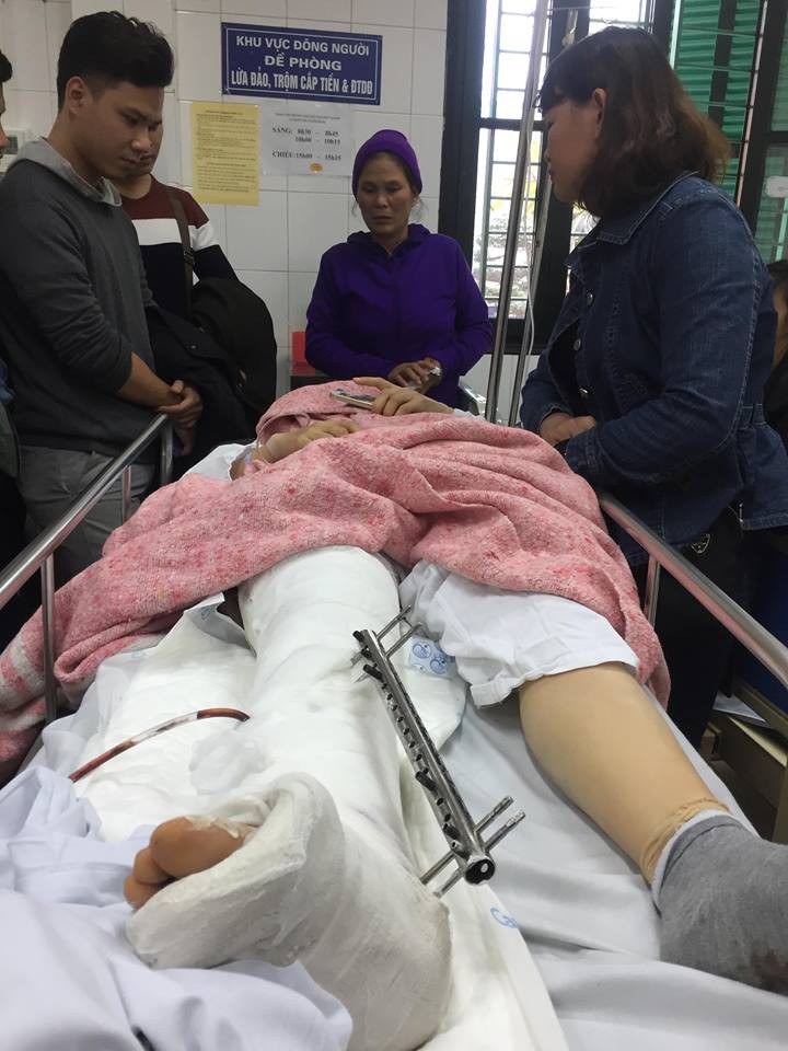 Nữ giáo viên kể lại giây phút bị xe điên Lexus đâm bay lên vỉa hè: Cảm giác chân phải như rời ra khỏi người, tôi tưởng mình đã chết rồi-4