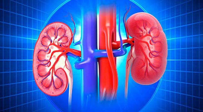 4 dấu hiệu cảnh báo thận bị ứ nước có thể khiến bạn gặp nguy hiểm: Hãy khẩn trương đi khám-3