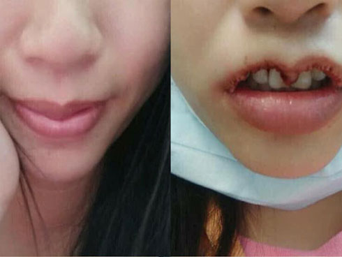 Khi bạn muốn đôi môi trái tim, còn bác sĩ lại muốn khắc nguyên hình trái tim lên mặt bạn...-9