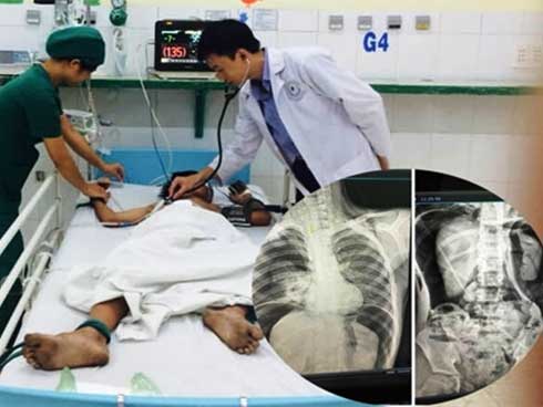 GS chỉ 2 bảo bối” chấm dứt viêm đại tràng, cắt đứt con đường phát triển thành mãn tính-3