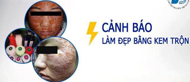 Bôi kem trộn, mặt thiếu nữ sưng vù, chi chít mụn mủ chưa từng thấy-2