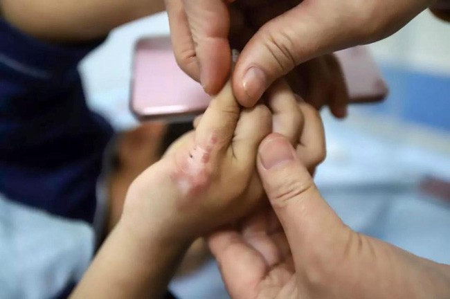 Người đàn ông chết lặng phát hiện tội ác của vợ mới khi nhìn thấy con bị bỏng, bộ phận sinh dục bị tổn thương-3