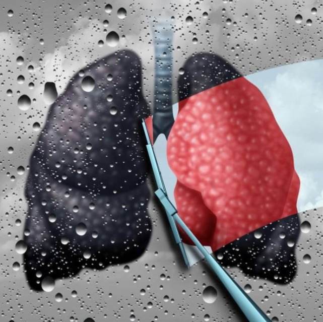 5 thực phẩm được ví là máy hút bụi cho phổi: Thường xuyên ăn, phổi sẽ được dọn sạch sẽ-1