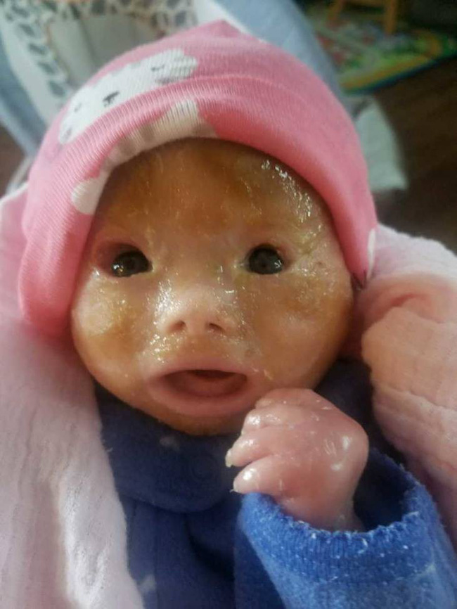 Mong đợi ngày con gái chào đời, mẹ lặng người khi lần đầu nhìn thấy khuôn mặt con-2
