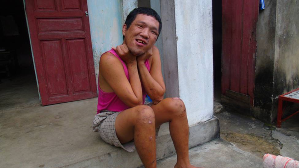 Gánh nặng của cụ ông 64 tuổi một mình chăm con tâm thần, vợ tai biến: Nếu tôi chết, vợ con sẽ sống thế nào đây?-2