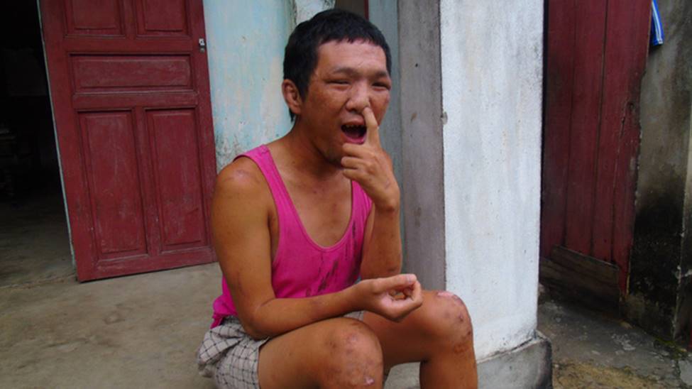 Gánh nặng của cụ ông 64 tuổi một mình chăm con tâm thần, vợ tai biến: Nếu tôi chết, vợ con sẽ sống thế nào đây?-3