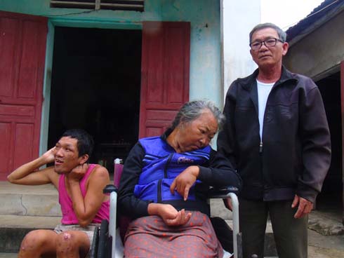 Cơ cực cuộc đời nữ sinh mê karatedo sau tai nạn giao thông-3