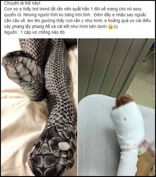 Sự thật đằng sau câu chuyện vợ trẻ bị chồng đánh nát chân vì đi tất hình rắn sexy-1