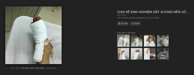 Sự thật đằng sau câu chuyện vợ trẻ bị chồng đánh nát chân vì đi tất hình rắn sexy-3