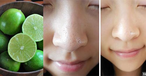 1001 công dụng làm đẹp của chanh, dù là mỹ phẩm tiền triệu cũng không so bì được-1