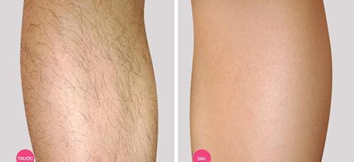 1001 công dụng làm đẹp của chanh, dù là mỹ phẩm tiền triệu cũng không so bì được-2