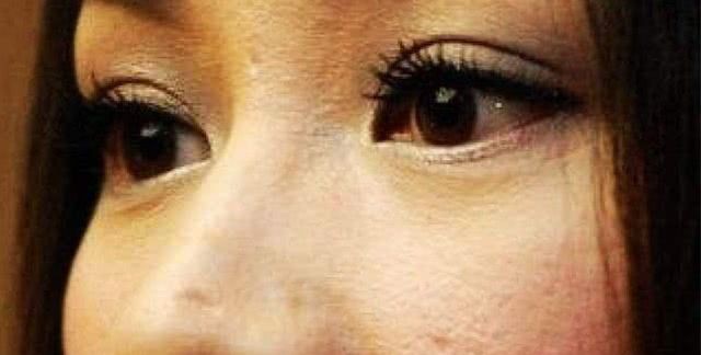 Mẹ trẻ bị xơ gan, bận nuôi con nhỏ không đi chữa, 2 năm sau khám lại thì gan đã vữa-1