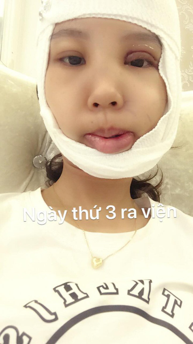 Tổng tập những gương mặt vịt hóa thiên nga” thành công nhờ dao kéo năm 2018, Duyên Phạm là bất ngờ nhất-1