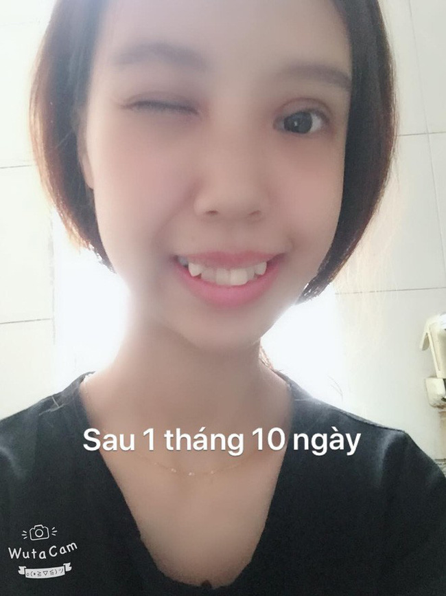 Tổng tập những gương mặt vịt hóa thiên nga” thành công nhờ dao kéo năm 2018, Duyên Phạm là bất ngờ nhất-2