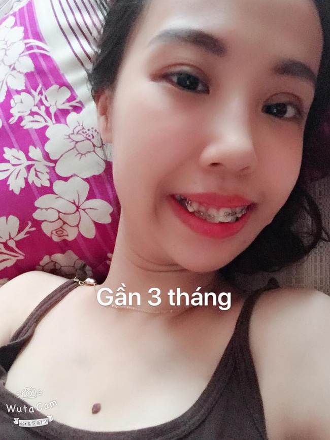 Tổng tập những gương mặt vịt hóa thiên nga” thành công nhờ dao kéo năm 2018, Duyên Phạm là bất ngờ nhất-3