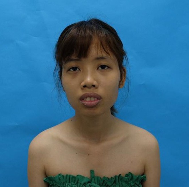 Tổng tập những gương mặt vịt hóa thiên nga” thành công nhờ dao kéo năm 2018, Duyên Phạm là bất ngờ nhất-5