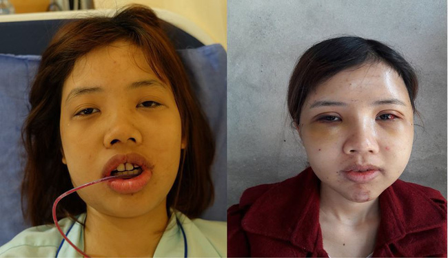 Tổng tập những gương mặt vịt hóa thiên nga” thành công nhờ dao kéo năm 2018, Duyên Phạm là bất ngờ nhất-6