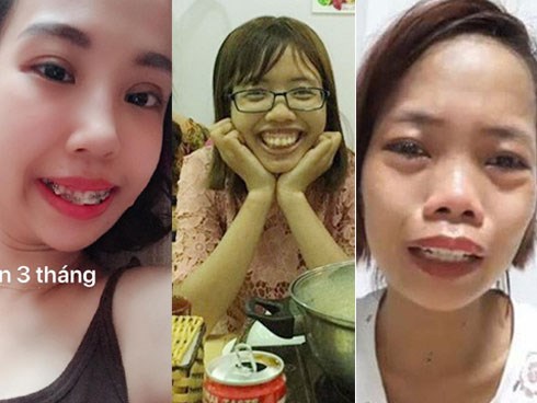 Tổng tập những gương mặt “vịt hóa thiên nga” thành công nhờ dao kéo năm 2018, Duyên Phạm là bất ngờ nhất