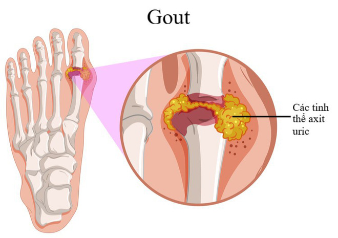 5 nhóm người không nên ăn cá để tránh gây hại lớn cho sức khỏe: Hãy xem có bạn không?-2