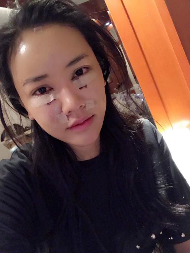 Bình thường đã đẹp rồi, vì sao Elly Trần và 3 bà mẹ đơn thân này vẫn đi... sửa mặt?-9