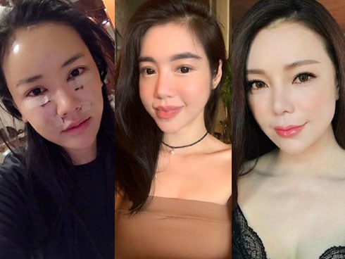 Bình thường đã đẹp rồi, vì sao Elly Trần và 3 bà mẹ đơn thân này vẫn đi... sửa mặt?