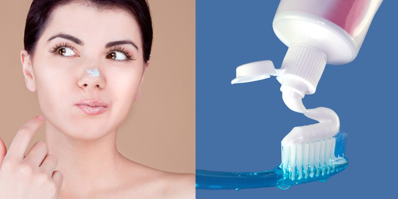 Đang bị mụn cần tránh làm 5 việc này để không làm tình trạng mụn thêm tồi tệ-1